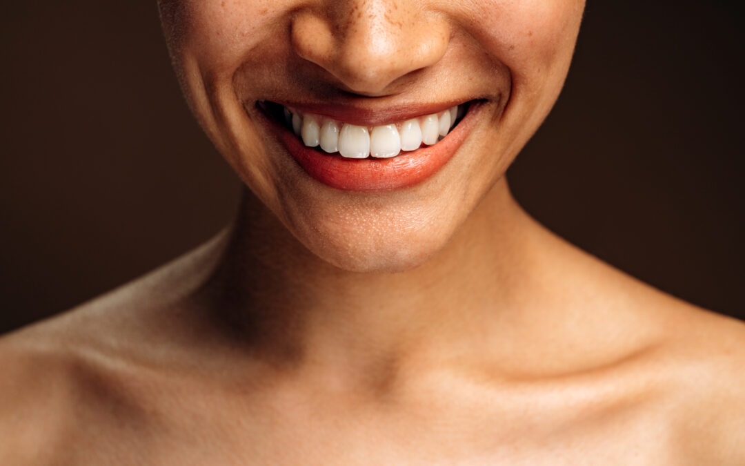 How Much is Teeth Whitening: What Patients Need to Know