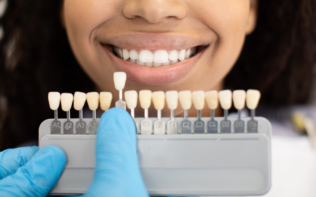 Understanding White Spots on Teeth